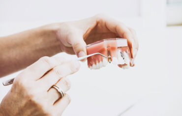 Periodontal Therapy